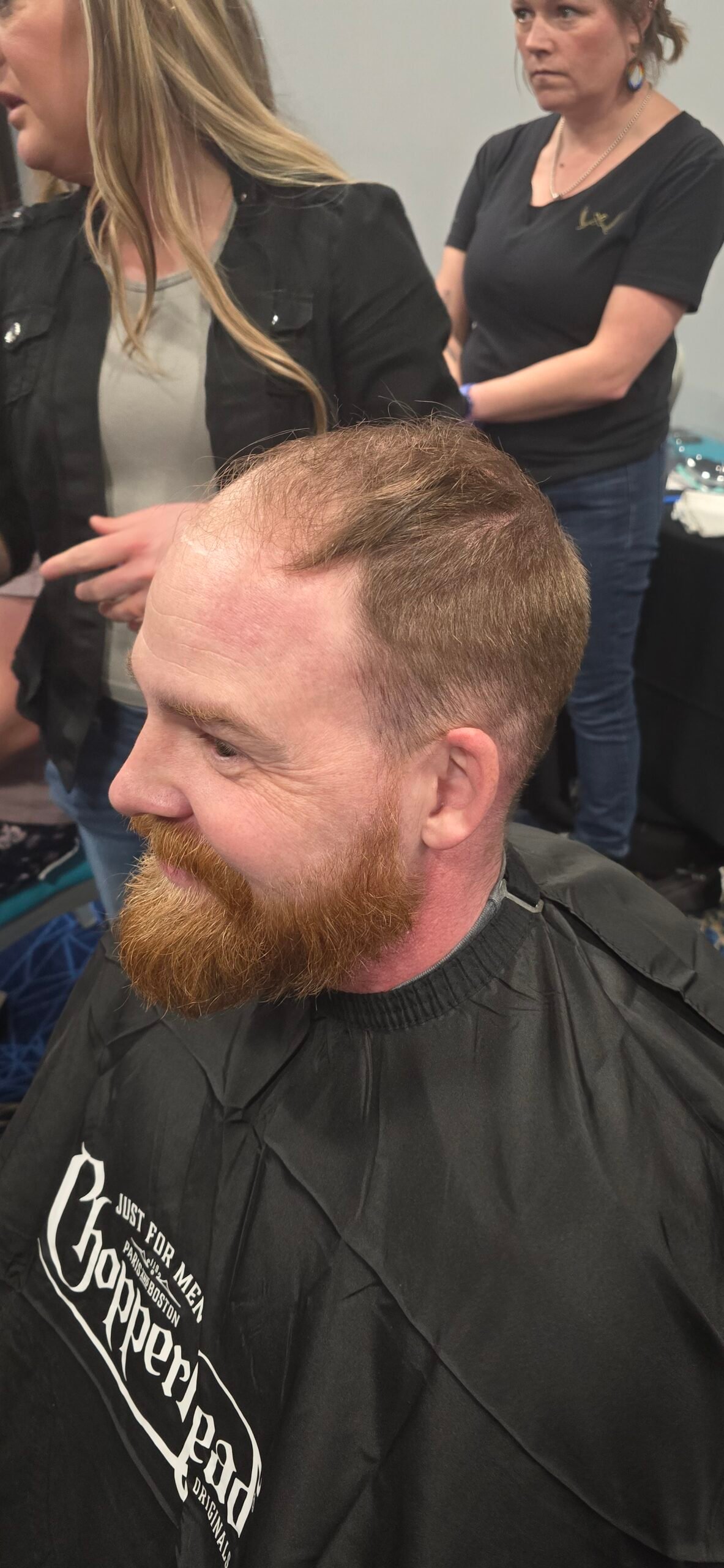 Before hair replacement