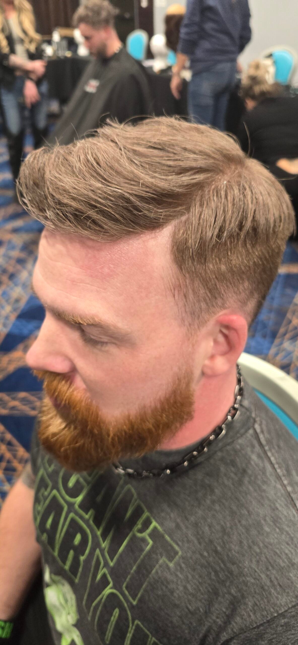 After hair replacement