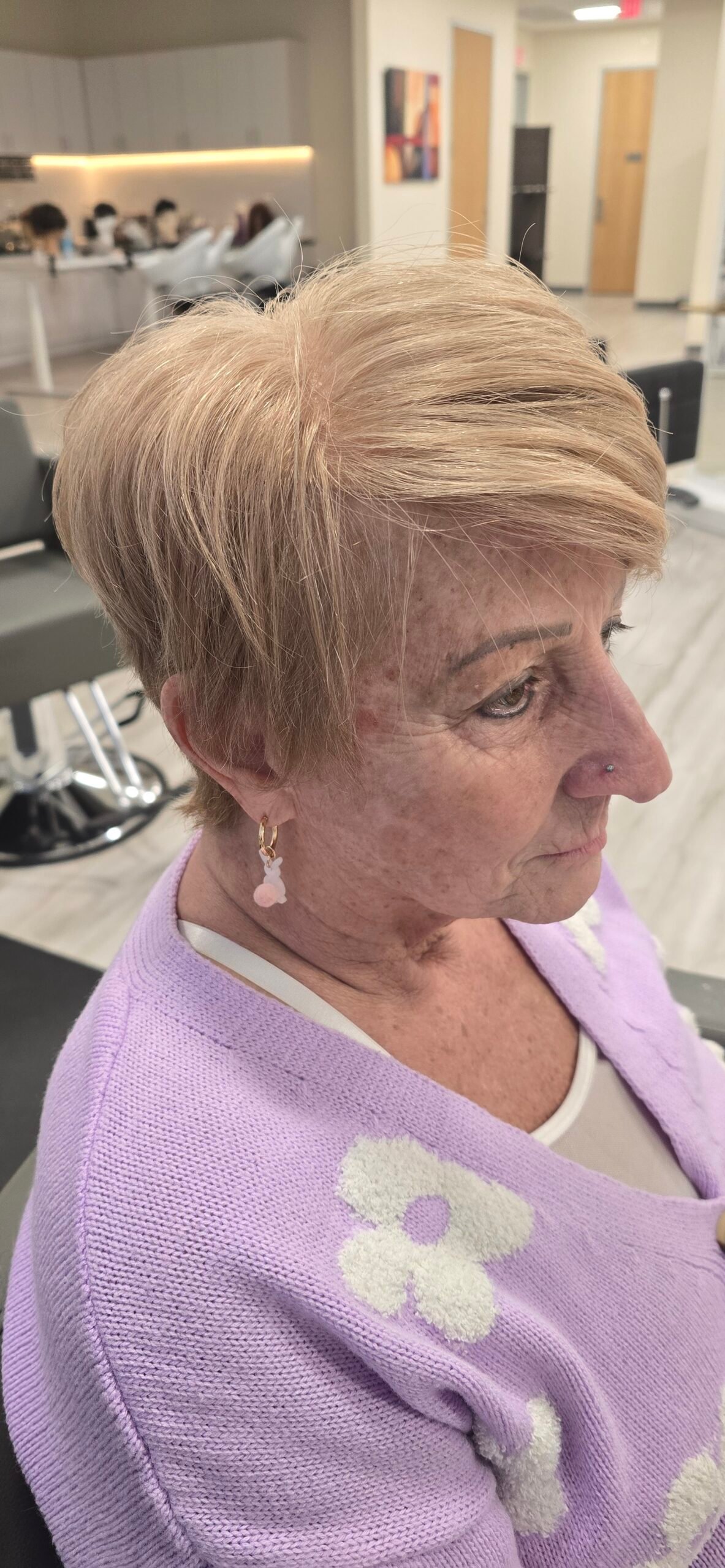 After hair restoration